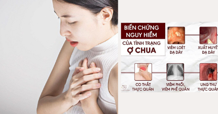 Hình ảnh nhóm sản phẩm Ợ CHUA LIÊN TỤC – CHỚ ĐỪNG CHỦ QUAN