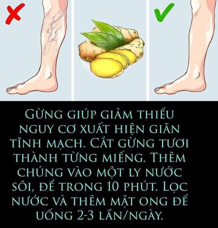 Gừng giúp giảm thiểu nguy cơ xuất hiện giãn tĩnh mạch.