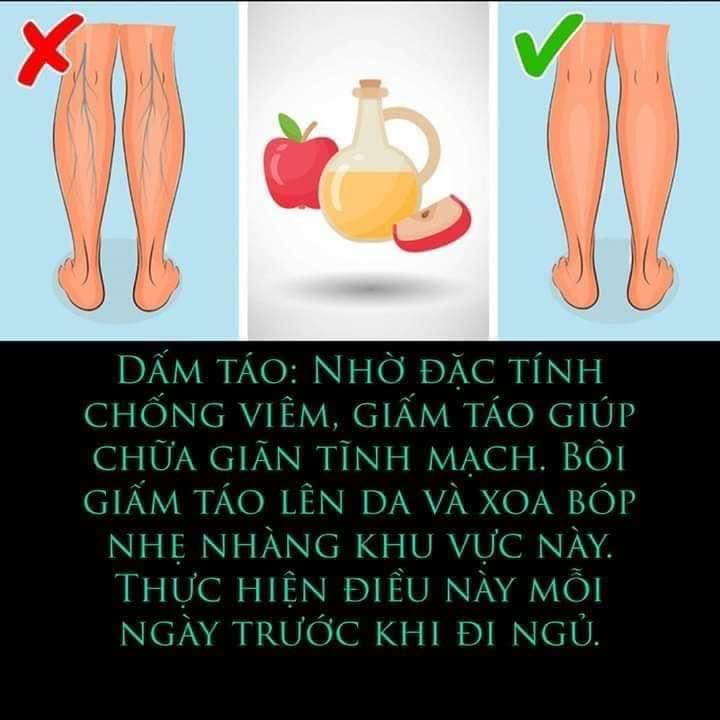 Nhờ đặc tính chống viêm, giấm táo giúp chữa giãn tĩnh mạch.